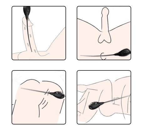 Máy Rung Niệu Đạo Hậu Môn Đồ Chơi SM